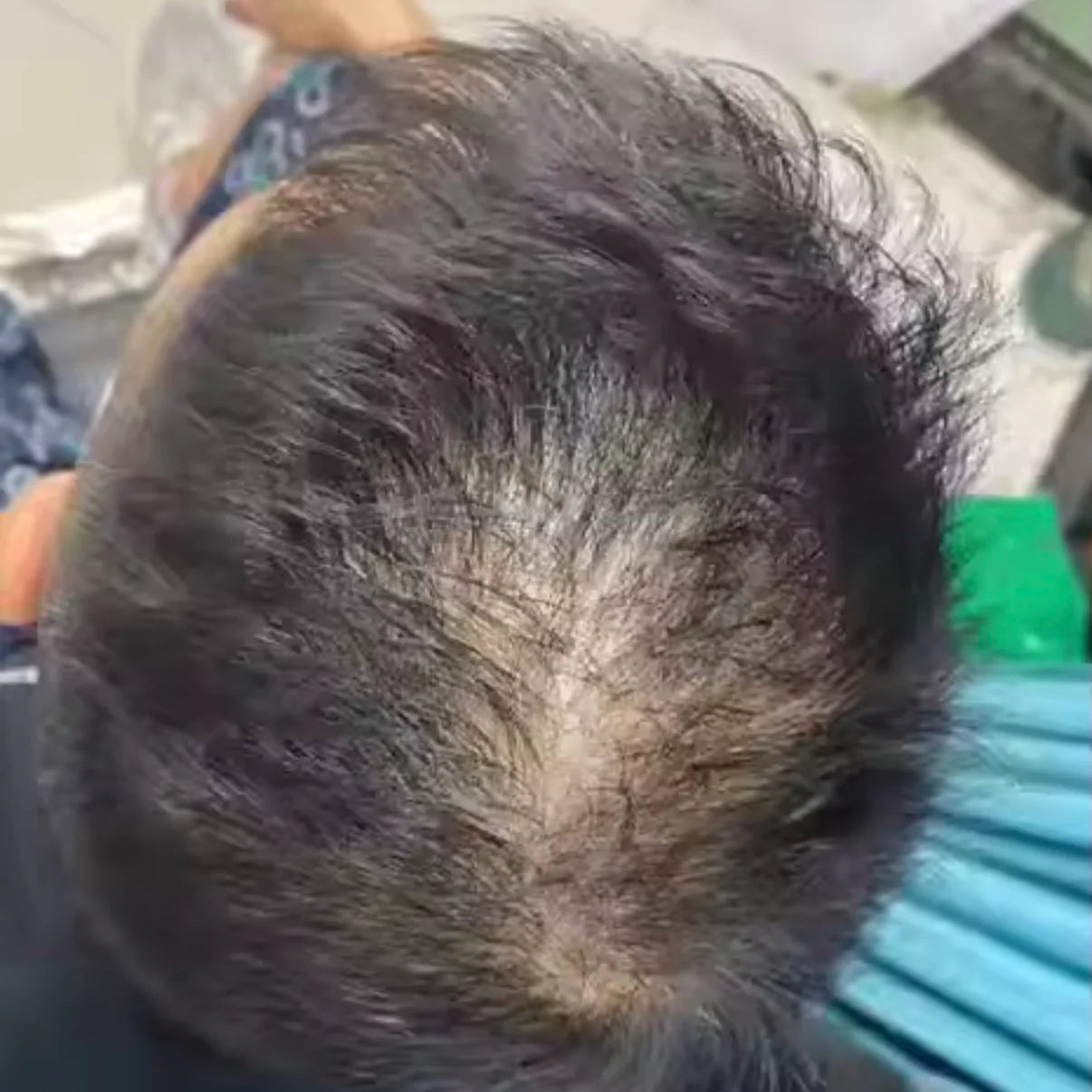 HairsKing™ – Crema Capilar Densidad Instantánea