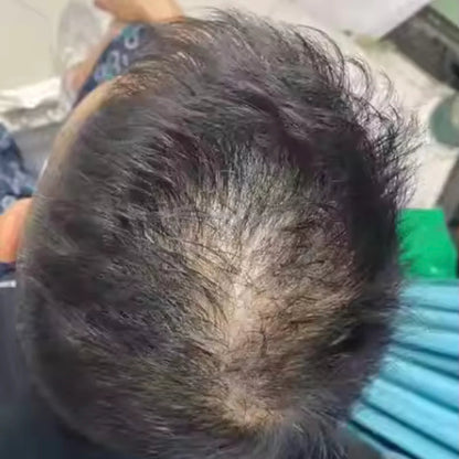 HairsKing™ – Crema Capilar Densidad Instantánea