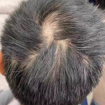 HairsKing™ – Crema Capilar Densidad Instantánea